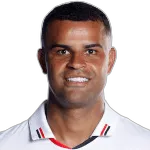 ALISSON